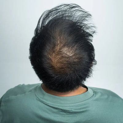 Barba - Prima