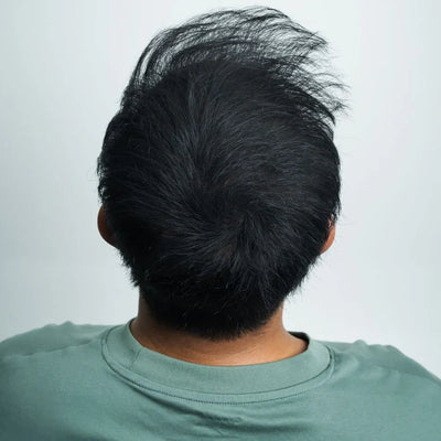 Barba - Dopo